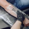 The Revolutionary Method of Saline Tattoo Removal