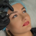 Tattoo Removal: What You Need to Know During Pregnancy and Breastfeeding