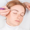 The Truth About Downtime After a Saline Tattoo Removal Session