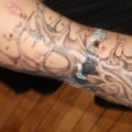 The Ins and Outs of Saline Tattoo Removal