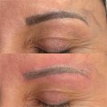 The Natural and Non-Invasive Way to Remove Tattoos: Saline Tattoo Removal