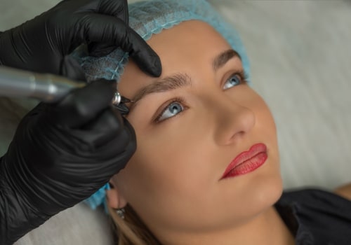 The Truth About Saline Tattoo Removal: What to Expect