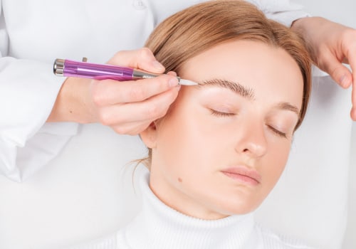 The Truth About Downtime After a Saline Tattoo Removal Session